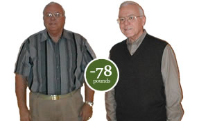 Barry lost 78 pounds Barry lost 78 pounds